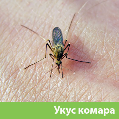 Укусы комаров в Казани